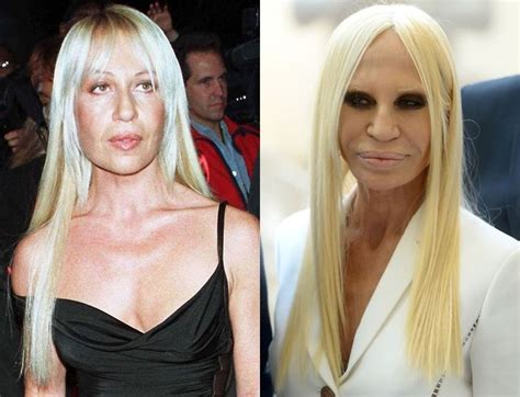 donatella versace cirugias|donatella versace facelift.